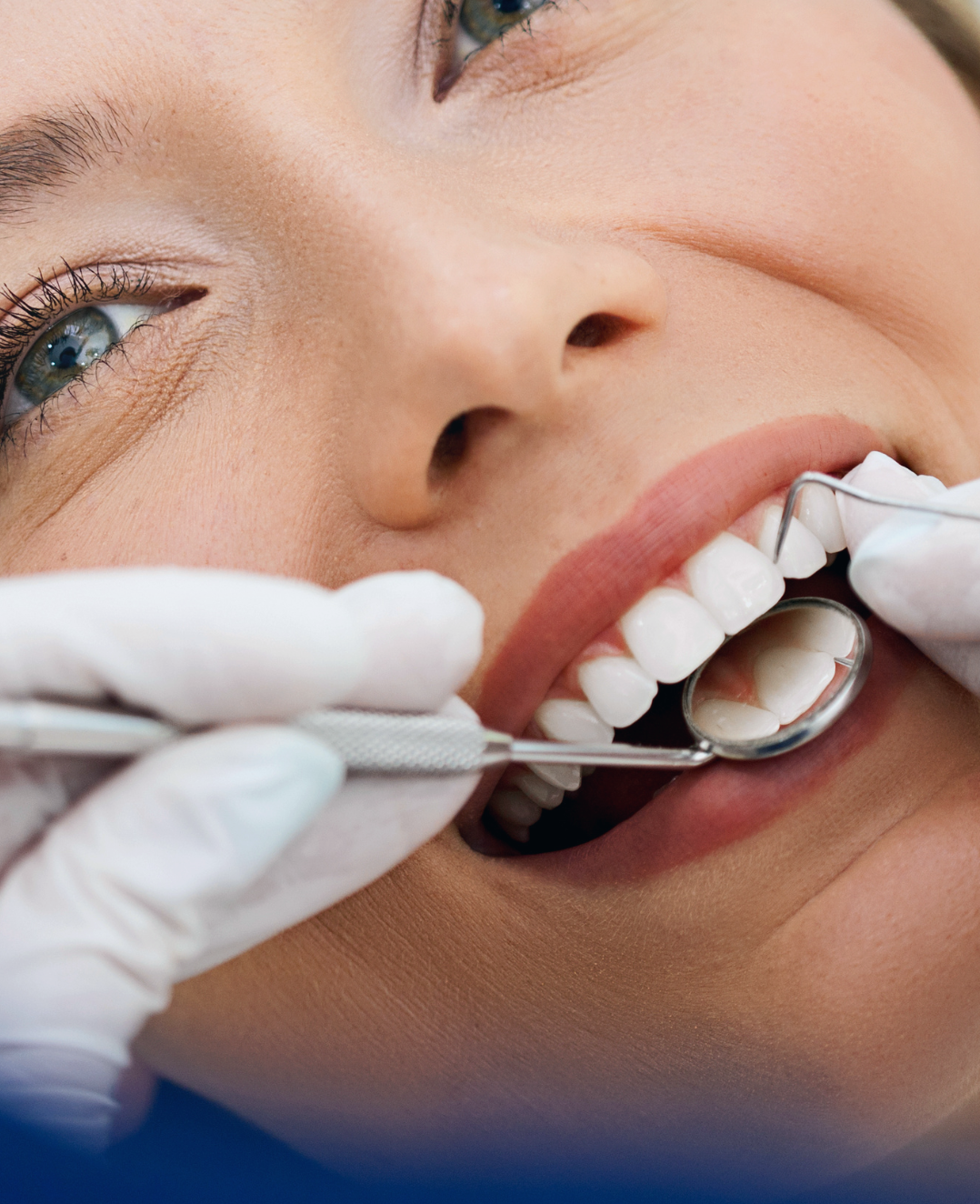 Cavities: Causes, Symptoms, and How to Prevent Tooth Decay