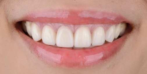 Complete Smile Makeover Guide: Transform Your Smile with Veneers, Whitening & Modern Cosmetic Dentistry