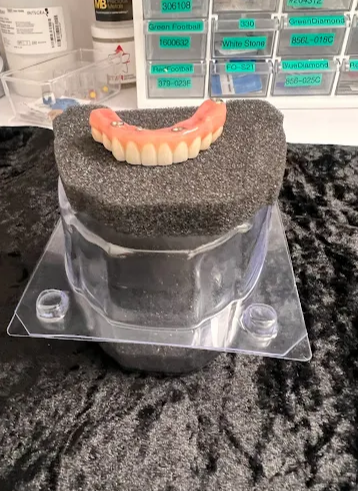 The Difference Between Dentures and Implant-Supported Dentures